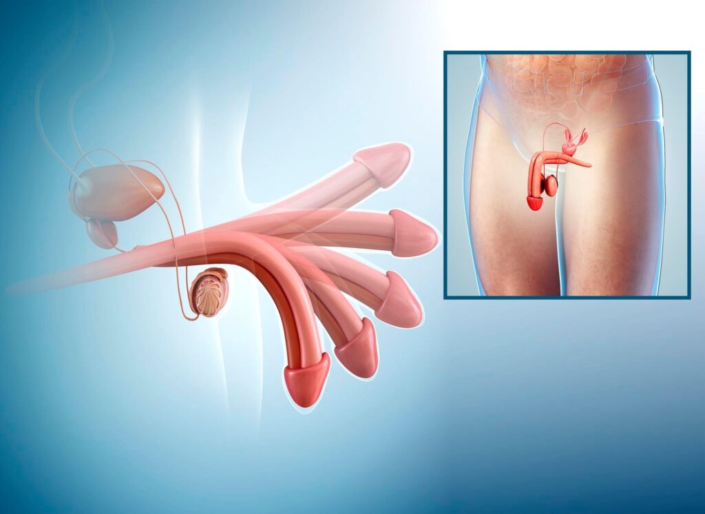 ERECTION OCCUR ERECTION OCCUR